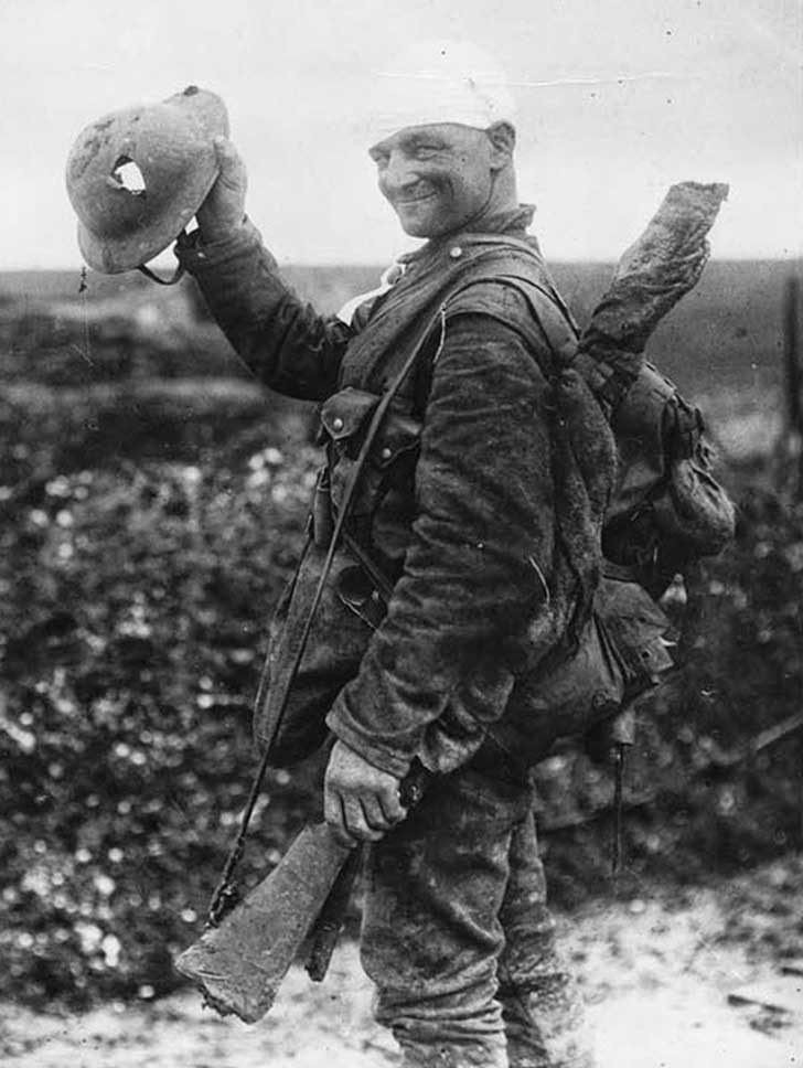 Um soldado britânico em 1918 mostra o capacete danificado.